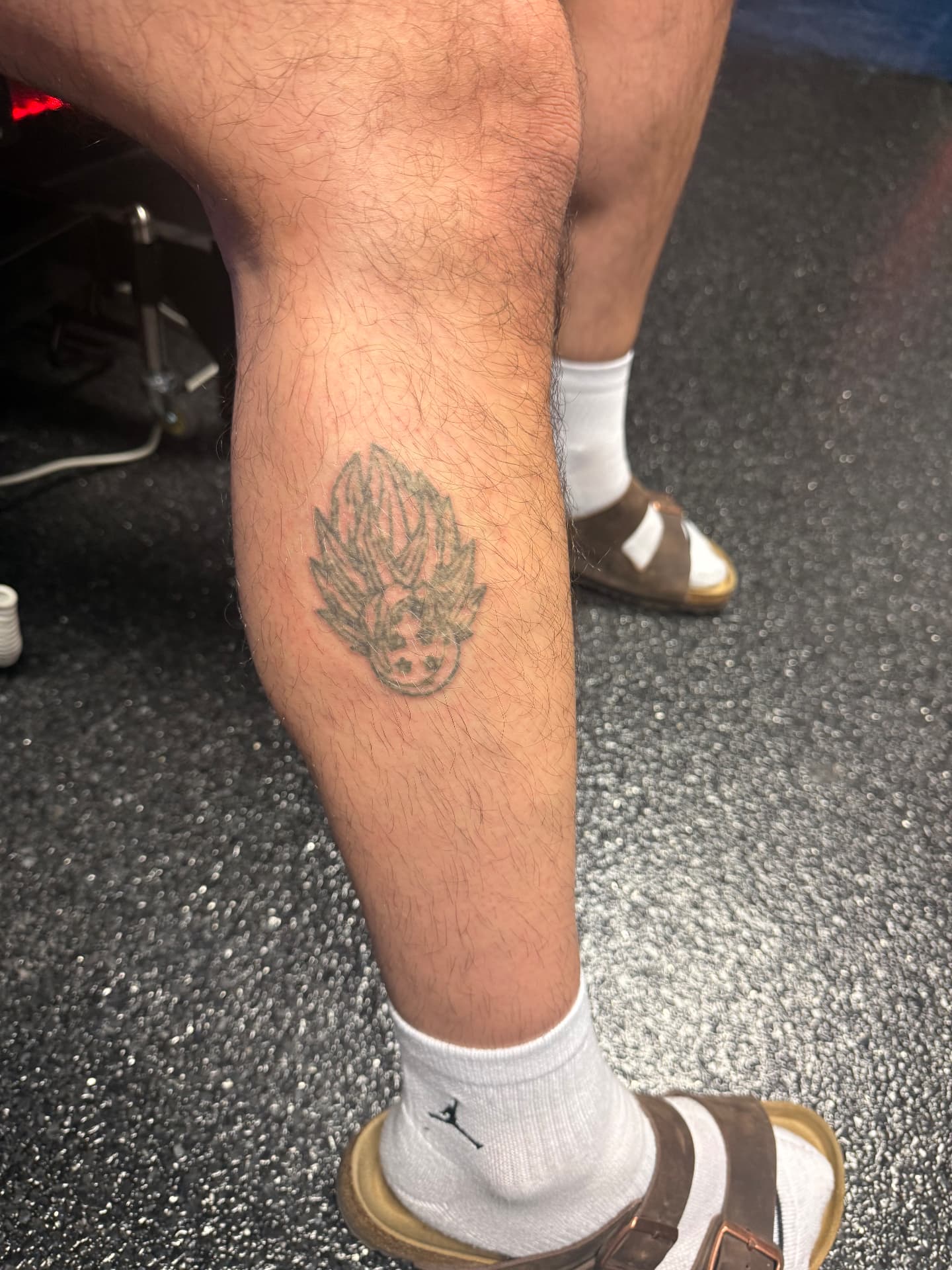 Calf tattoo breaking up after laser sessions