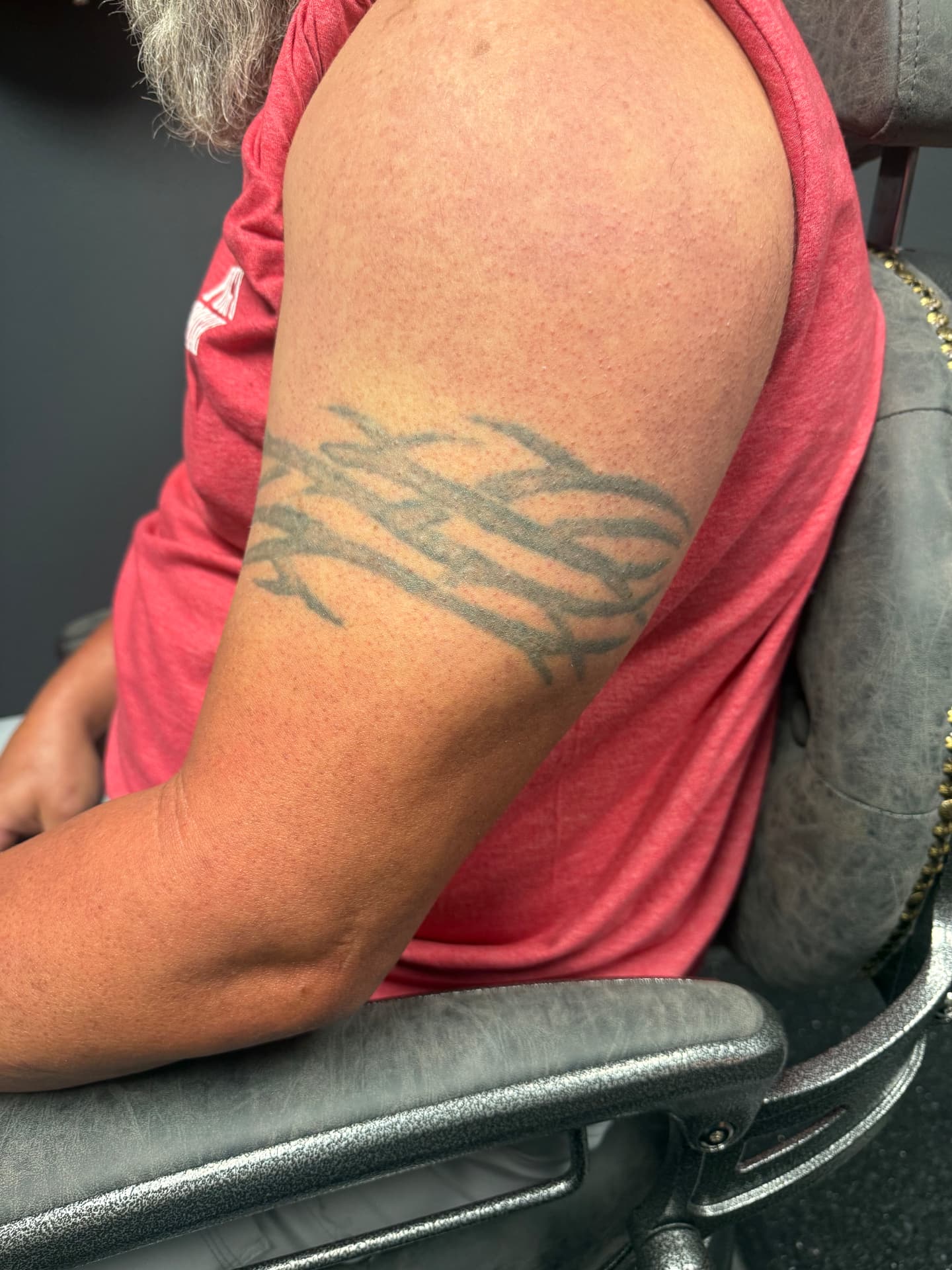 Tribal armband tattoo before laser treatment