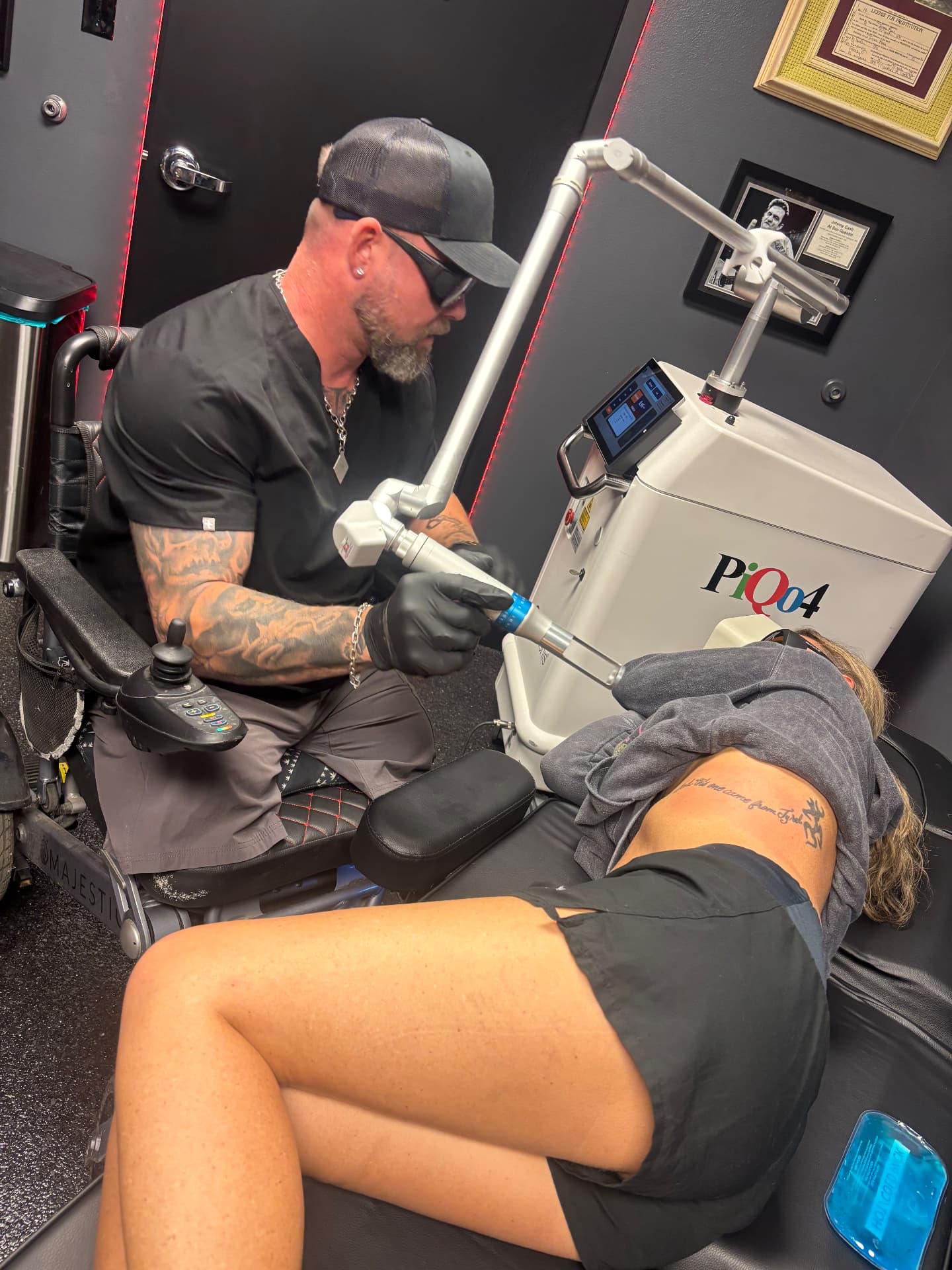 Will Ewing performing a laser tattoo removal session with the PiQo4 laser